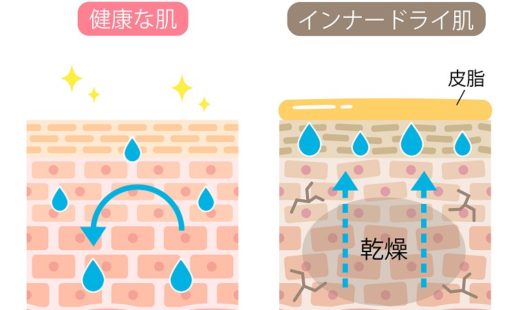 インナードライとは