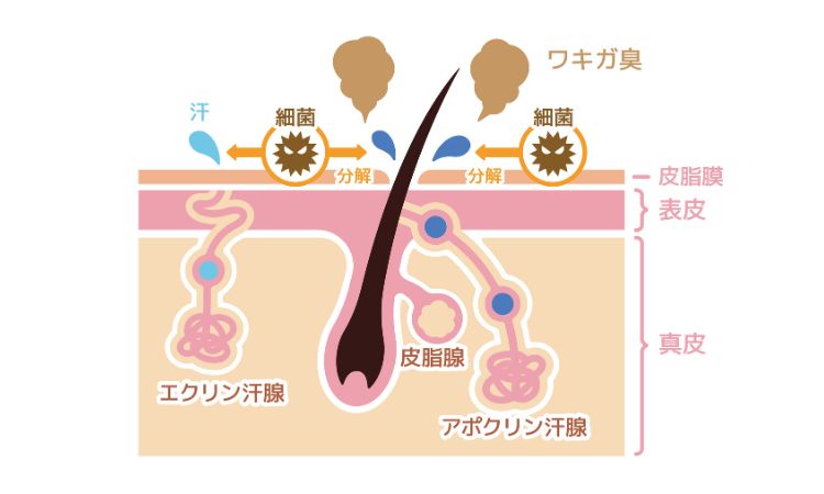 なぜ汗くさい？わきのにおいやワキガが発生する原因